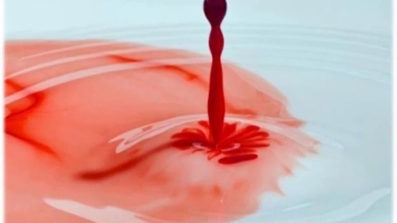 secreción sanguinolenta del pene